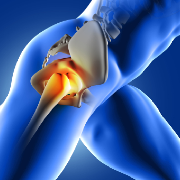 joint replacement Consultant in Pune